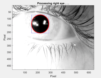 PDEYE4 Thumbnail